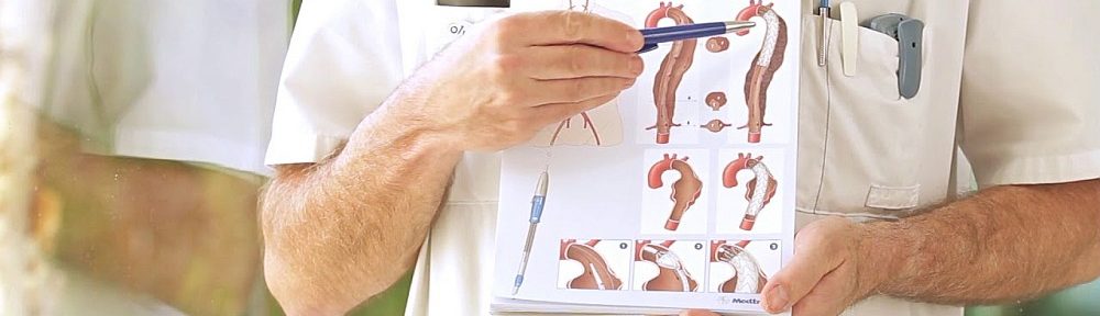 instructie aorta aandoeningen
